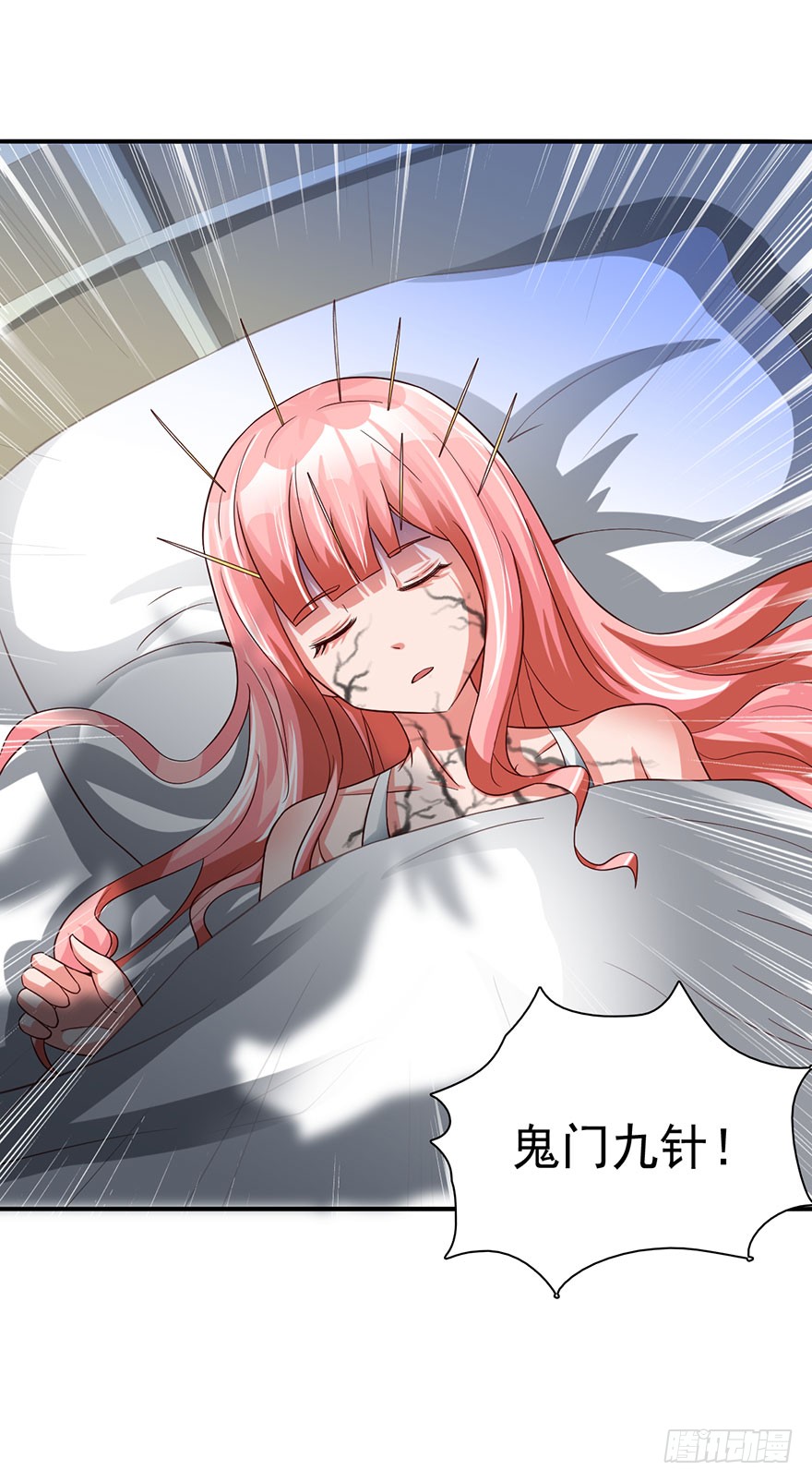 鬼门九针